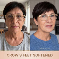 Crow's feet softened