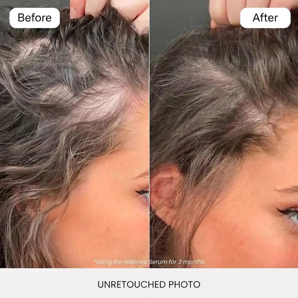 Before and after using the Nidoriva hair serum for 3 months