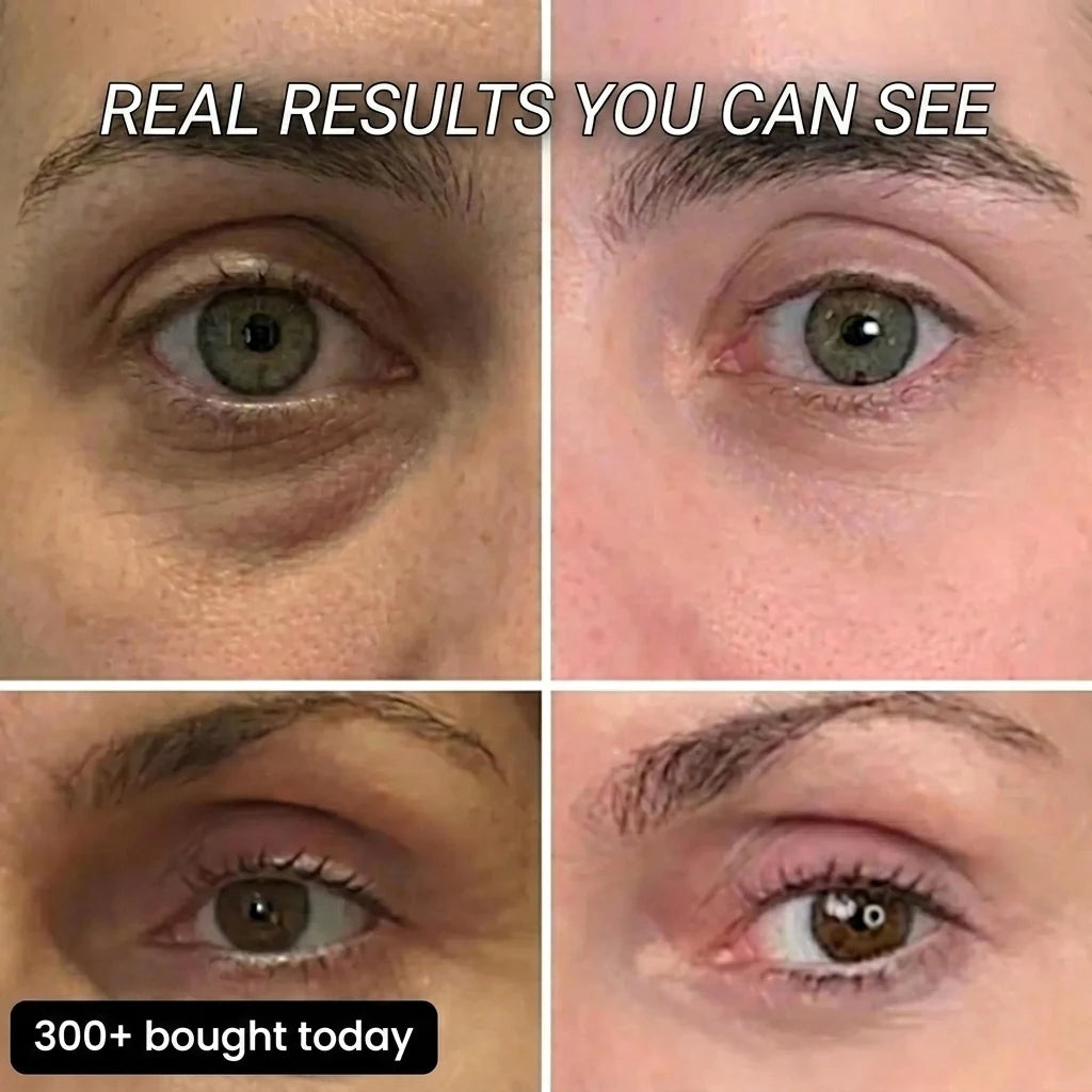 Real results you can see, eye area